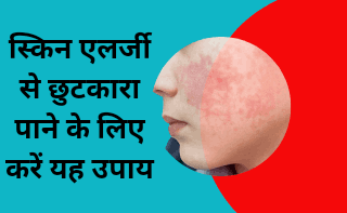 Home remedy for skin allergy